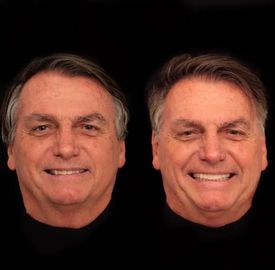 263350 - Veja o antes e depois da harmonização facial feita por Bolsonaro por .