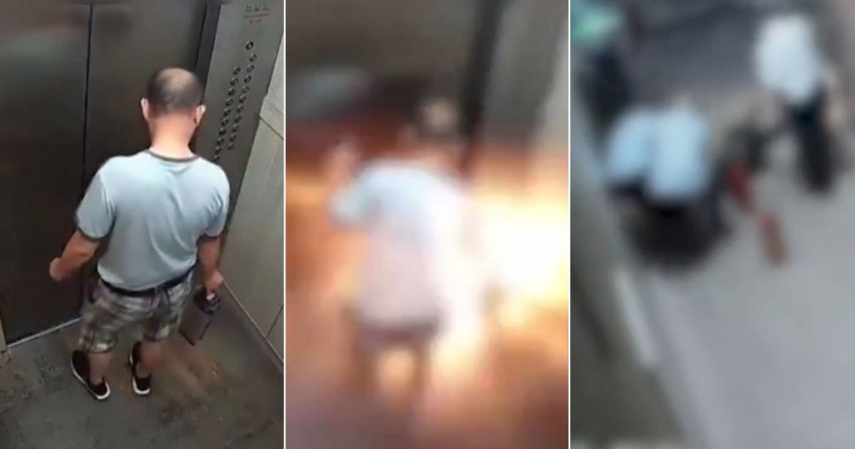Vítima transportando a bateria de lítio quando o equipamento explodiu.