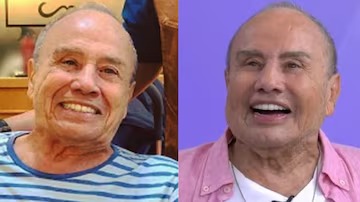 (Descrição)Ator Stenio Garcia no antes e depois da harmonização facial.