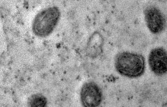 Mpox: EUA identificam primeiro caso de nova cepa em viajante