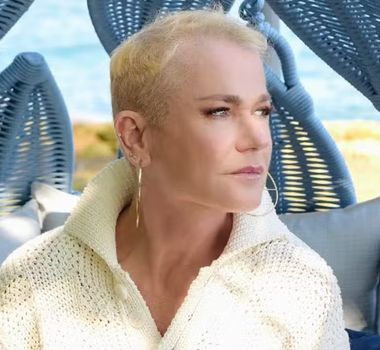 Imagem - Xuxa Meneghel revela diagnóstico de alopecia