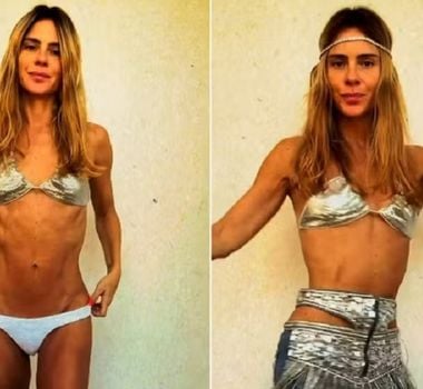 Imagem - Carolina Dieckmann rebate comentário sobre seu corpo e uso de Ozempic: sejamos gentis