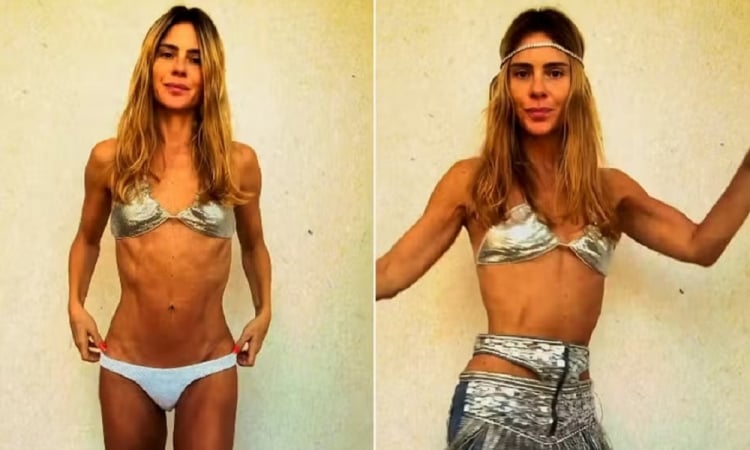 Imagem - Carolina Dieckmann rebate comentário sobre seu corpo e uso de Ozempic: sejamos gentis