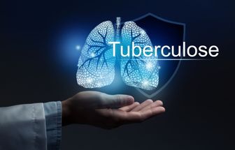 5 sintomas de alerta para a tuberculose