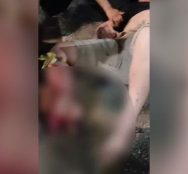 Imagem - Em Belém, policial que quase perde a perna em acidente passa por cirurgia e se recupera