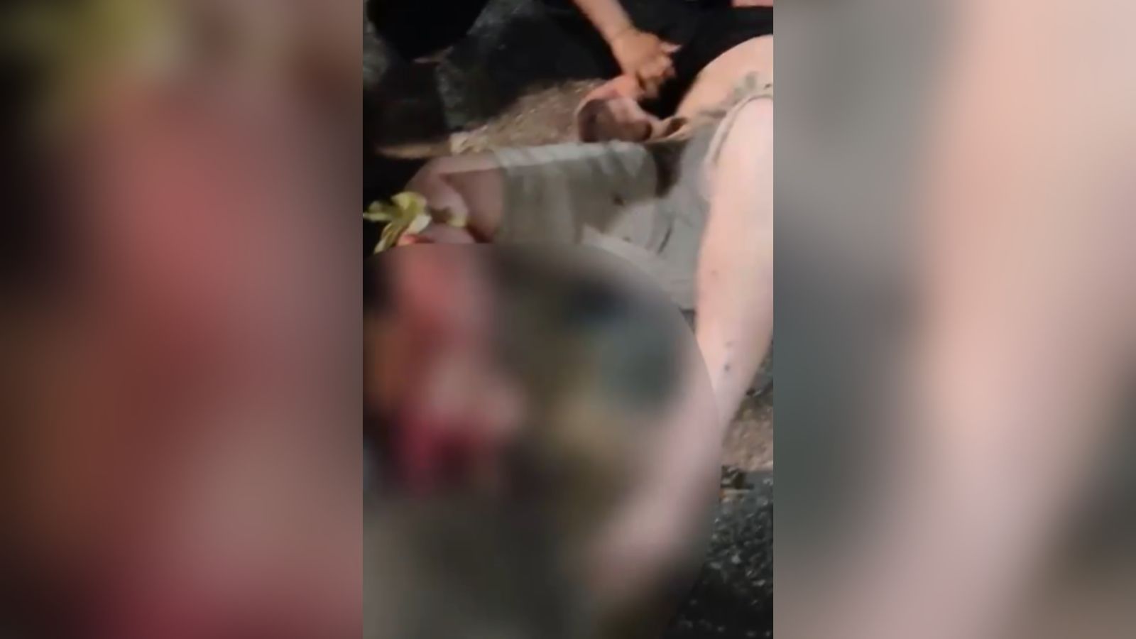 Imagem - Em Belém, policial que quase perde a perna em acidente passa por cirurgia e se recupera