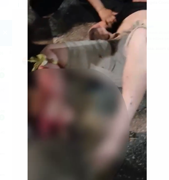 Imagem - Vídeo: policial sofre acidente em Belém e parte da perna quase é arrancada com a batida