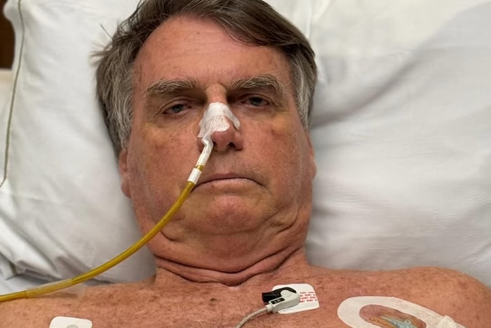 Imagem - 11º dia na UTI: Bolsonaro tem piora clínica