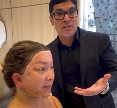Imagem - Vídeo de pós-operatório de 'full facelift' gera repercussão nas redes sociais