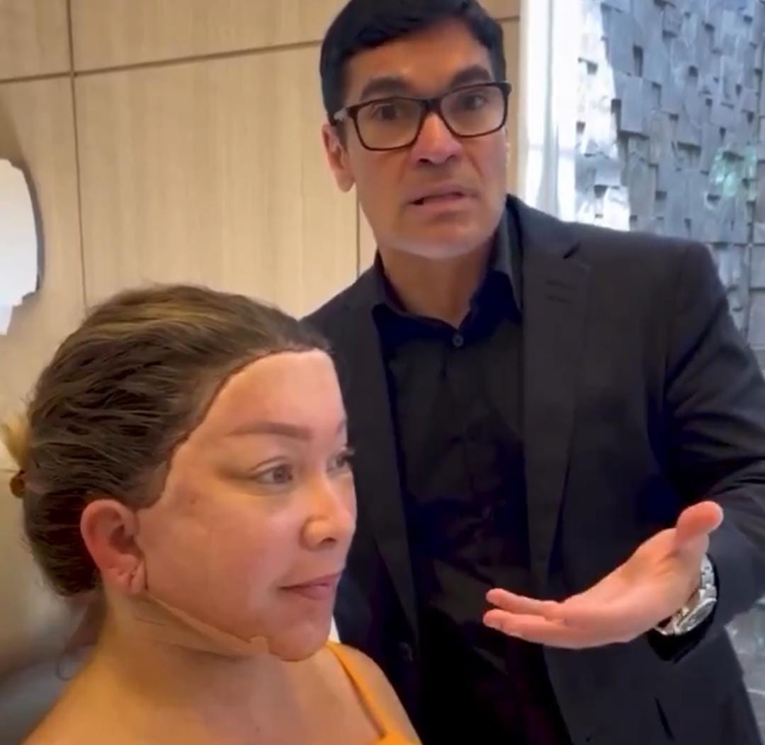 Imagem - Vídeo de pós-operatório de 'full facelift' gera repercussão nas redes sociais