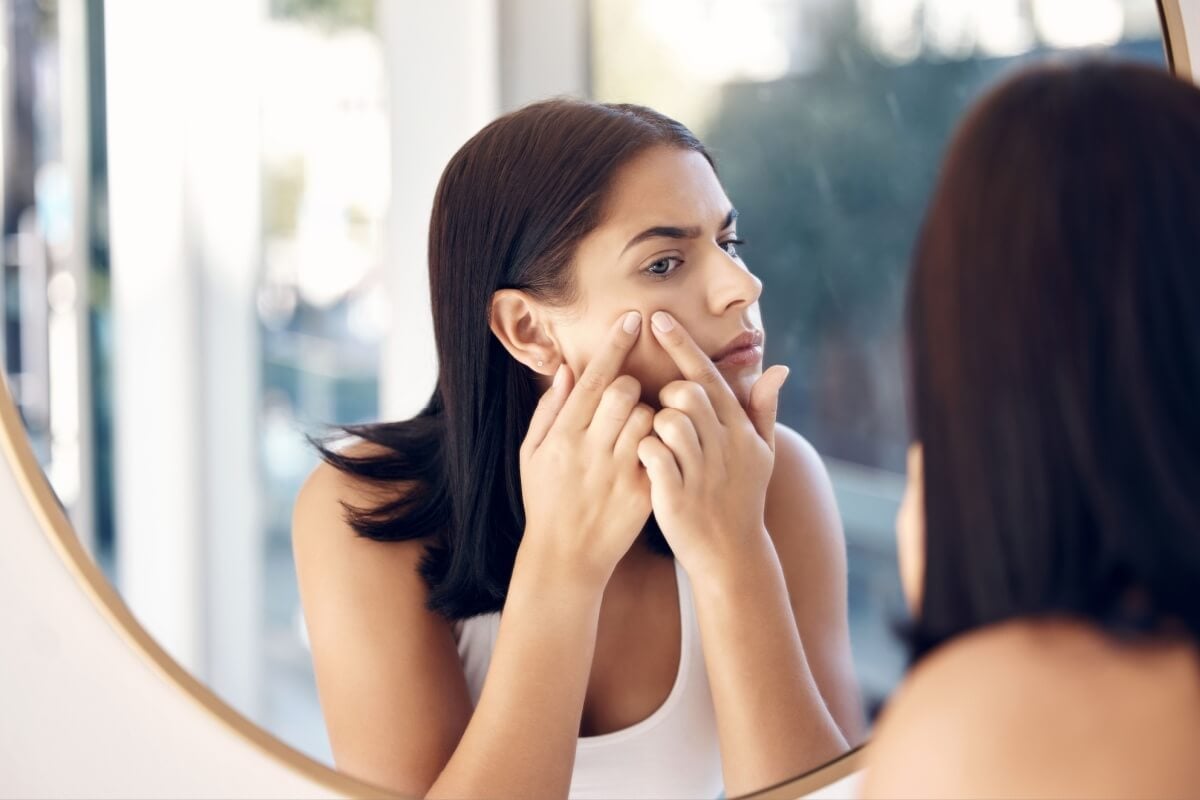 Imagem - 7 dicas para controlar a acne na vida adulta