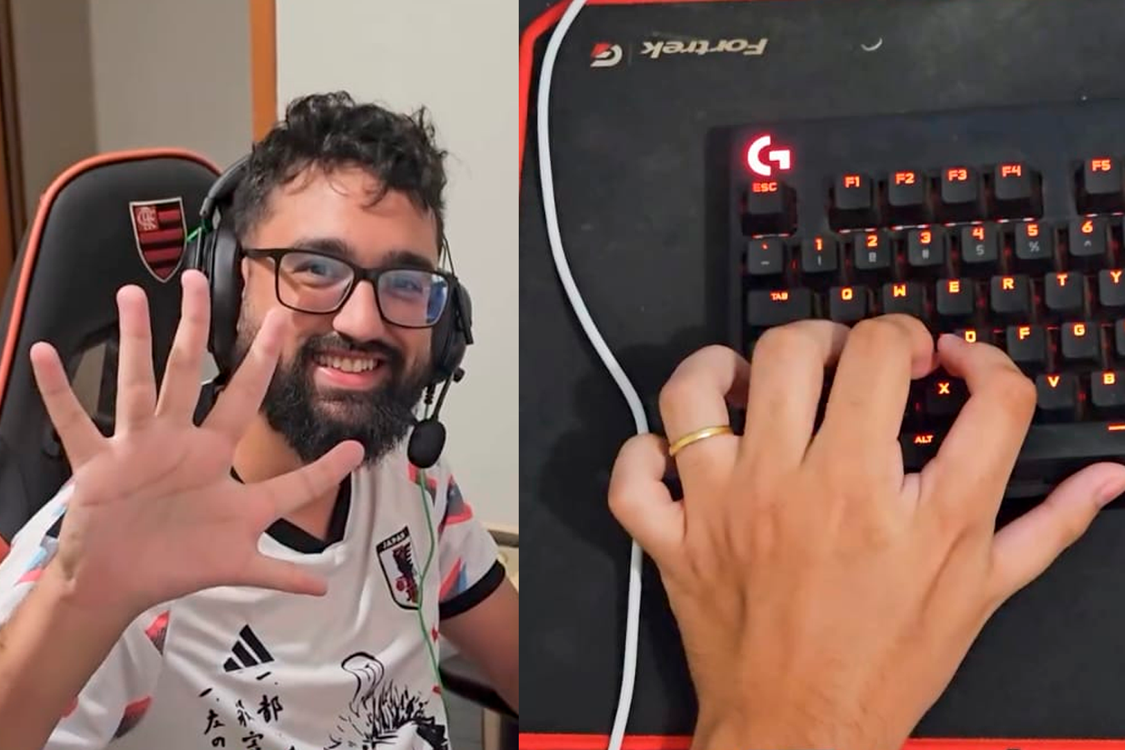 Imagem - Goleiro de seis dedos compartilha nova curiosidade e decide mostrar dia a dia na web