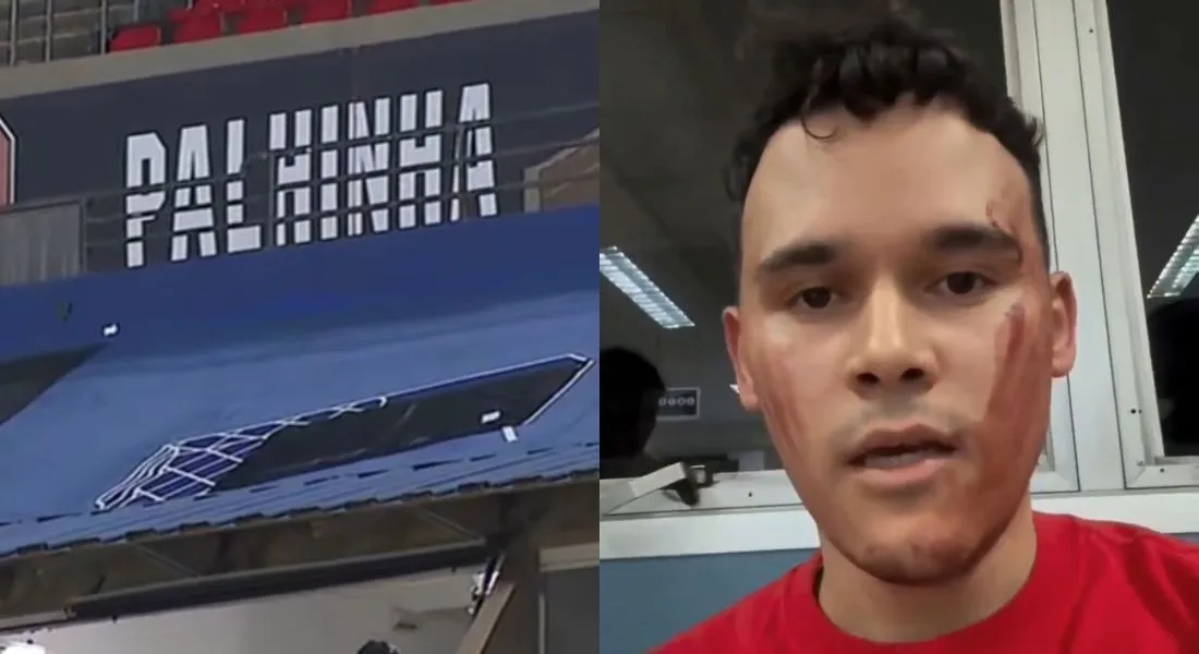 Imagem - Torcedores atingidos por placa no Morumbi seguem internados após passarem por cirurgias