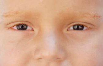 Teste ocular promete identificar autismo em bebês com 80% de precisão