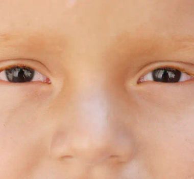 Imagem - Teste ocular promete identificar autismo em bebês com 80% de precisão