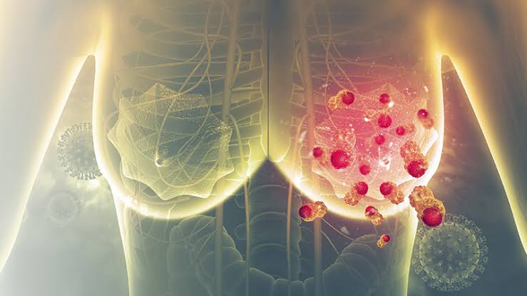 Imagem - Nova tecnologia promete facilitar o diagnóstico de câncer em pacientes com mamas densas