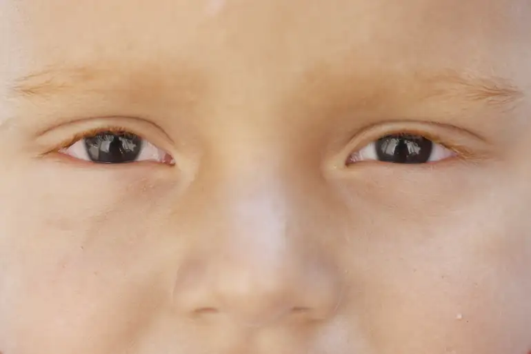 Imagem - Teste ocular promete identificar autismo em bebês com 80% de precisão