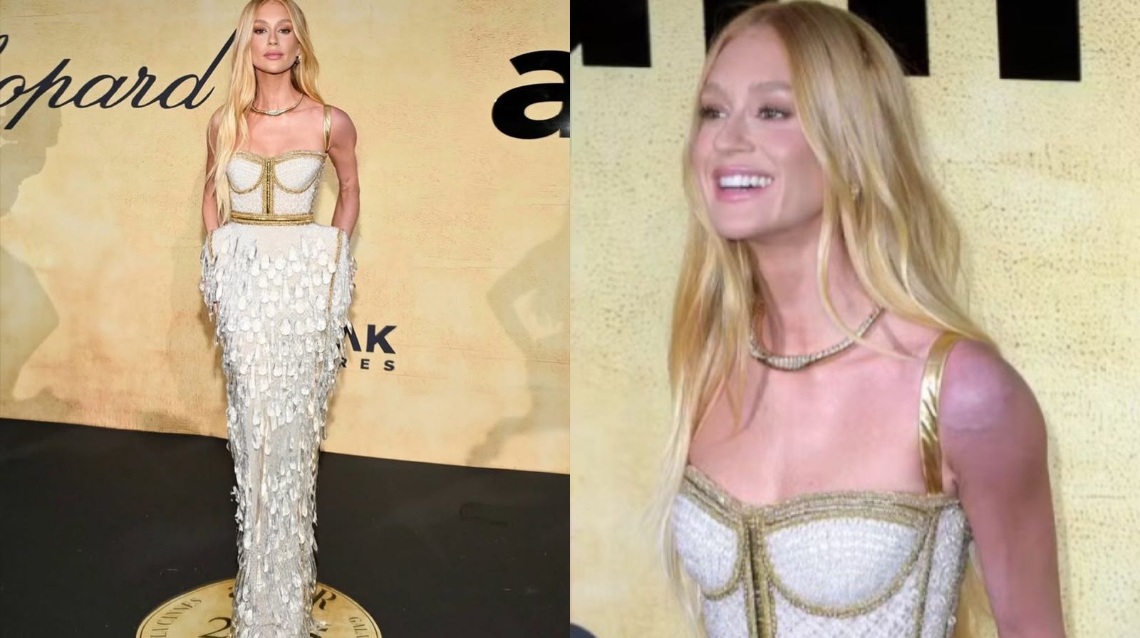 Imagem - Marina Ruy Barbosa esclarece motivo de ombro roxo durante tradicional baile em Cannes