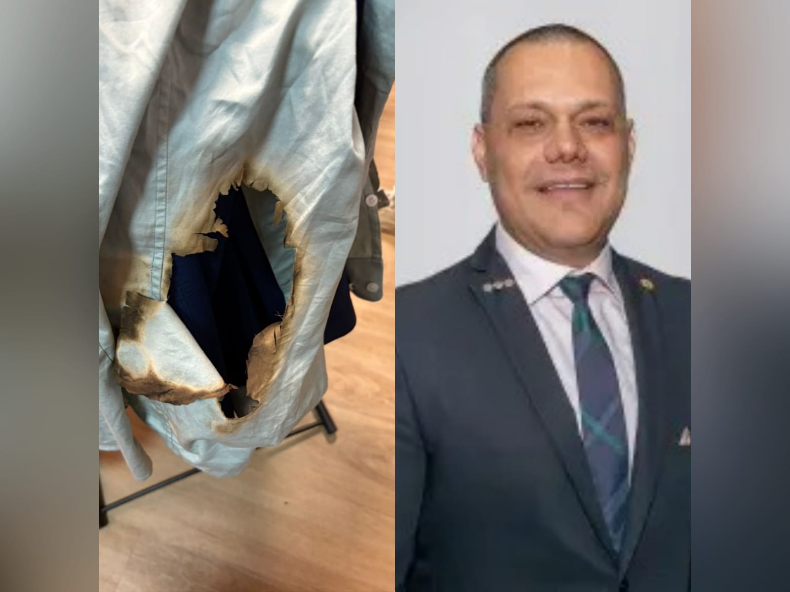 Imagem - Deputado Coronel Neil tem queimaduras de 2º grau após princípio de incêndio em restaurante da Alepa