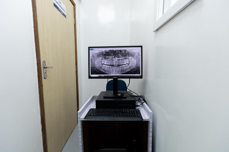 Imagem - Belém instala raio-x digital que deve dobrar atendimentos odontológicos na rede pública