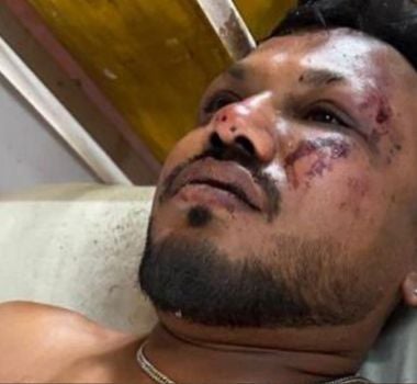 Imagem - Vídeo: homem sobrevive a queda de avião com mais de 200 mortos na Índia