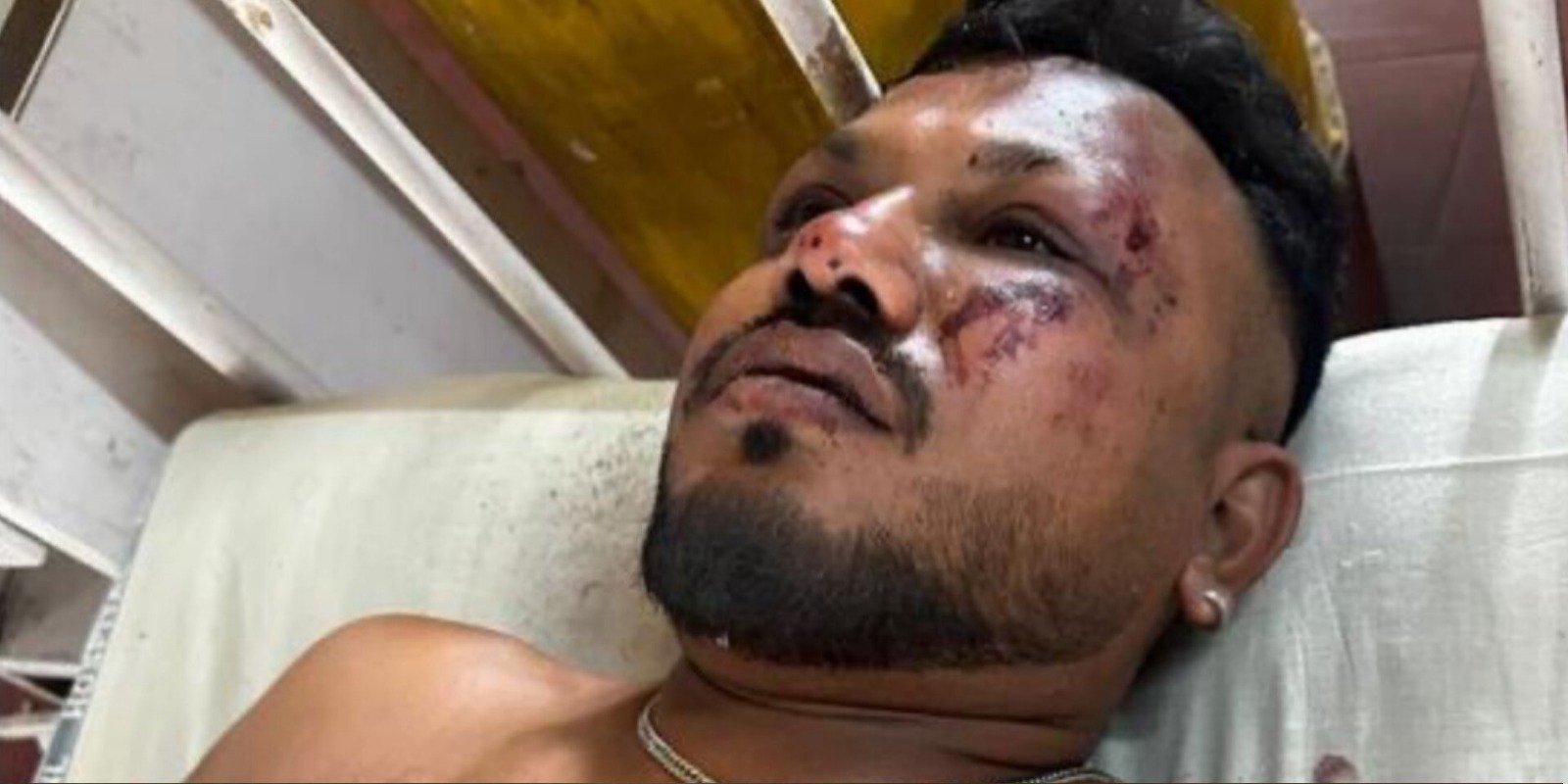 Imagem - Vídeo: homem sobrevive a queda de avião com mais de 200 mortos na Índia