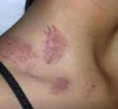 Imagem - Mulher é atacada por ‘lobisomem’ no quintal de casa, no Pará