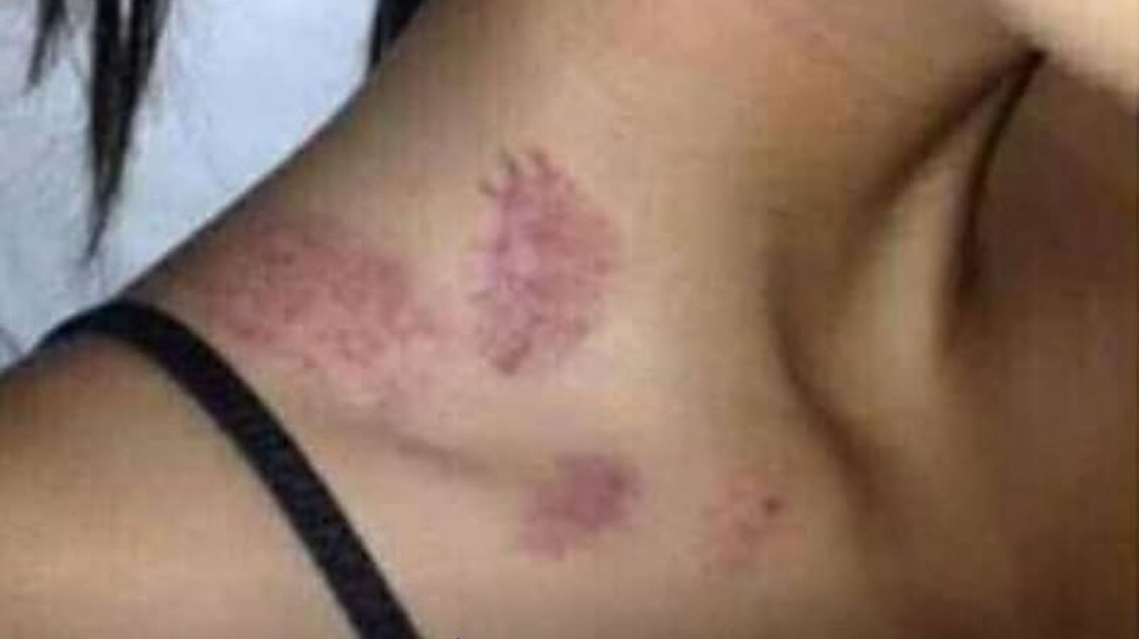 Mulher é atacada por ‘lobisomem’ no quintal de casa, no Pará.