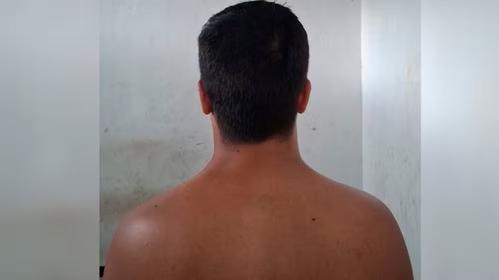 O prejuízo estimado gira em torno de R$ 100 mil.
