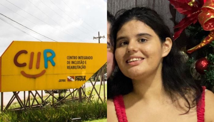Imagem - Jovem autista tem 17 dentes extraídos sem autorização durante procedimento no CIIR, em Belém