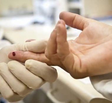 Imagem - Epidemia silenciosa por avanço do HIV causa alerta no Brasil; entenda