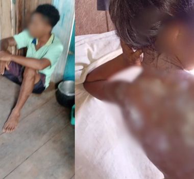 Imagem - Vídeo: padrasto é preso suspeito de jogar mingau quente em criança no Amazonas