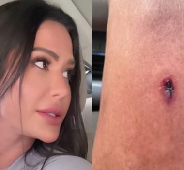Imagem - Gracyanne Barbosa sofre acidente na academia, mostra hematoma e desabafa: 'Treino frustrante'