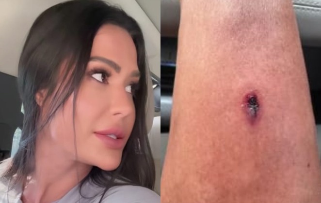 Gracyanne usou as redes sociais para relatar o acidente - 