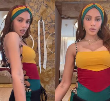 Imagem - Anitta reaparece após procedimento estético e web comenta nova aparência: 'outra pessoa'