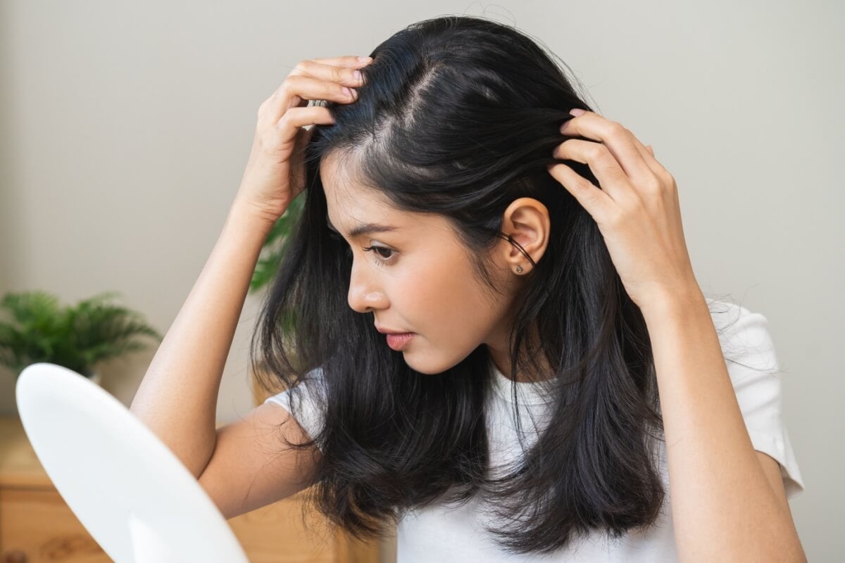 Cuidados simples ajudam a tratar a caspa sem agredir os cabelos (Imagem: Kmpzzz | Shutterstock) 