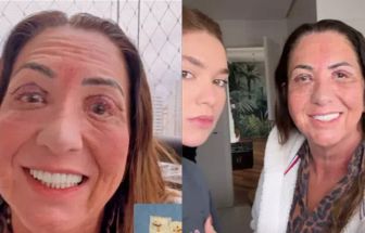 Mãe de Virgínia passa por cirurgia ocular e influenciadora exibe pele retirada: 'nojo'