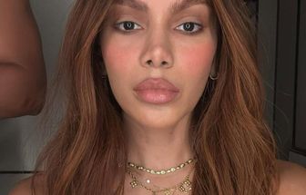 Anitta fala pela 1ª vez sobre novos procedimentos estéticos: 'o corpo é meu'