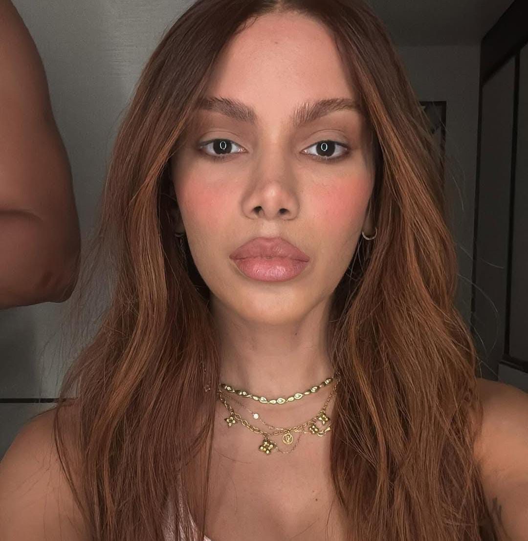 Imagem - Anitta fala pela 1ª vez sobre novos procedimentos estéticos: 'o corpo é meu'