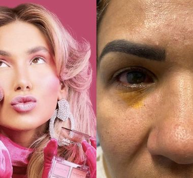 Imagem - Mulher relata cegueira após usar maquiagem de Virginia Fonseca
