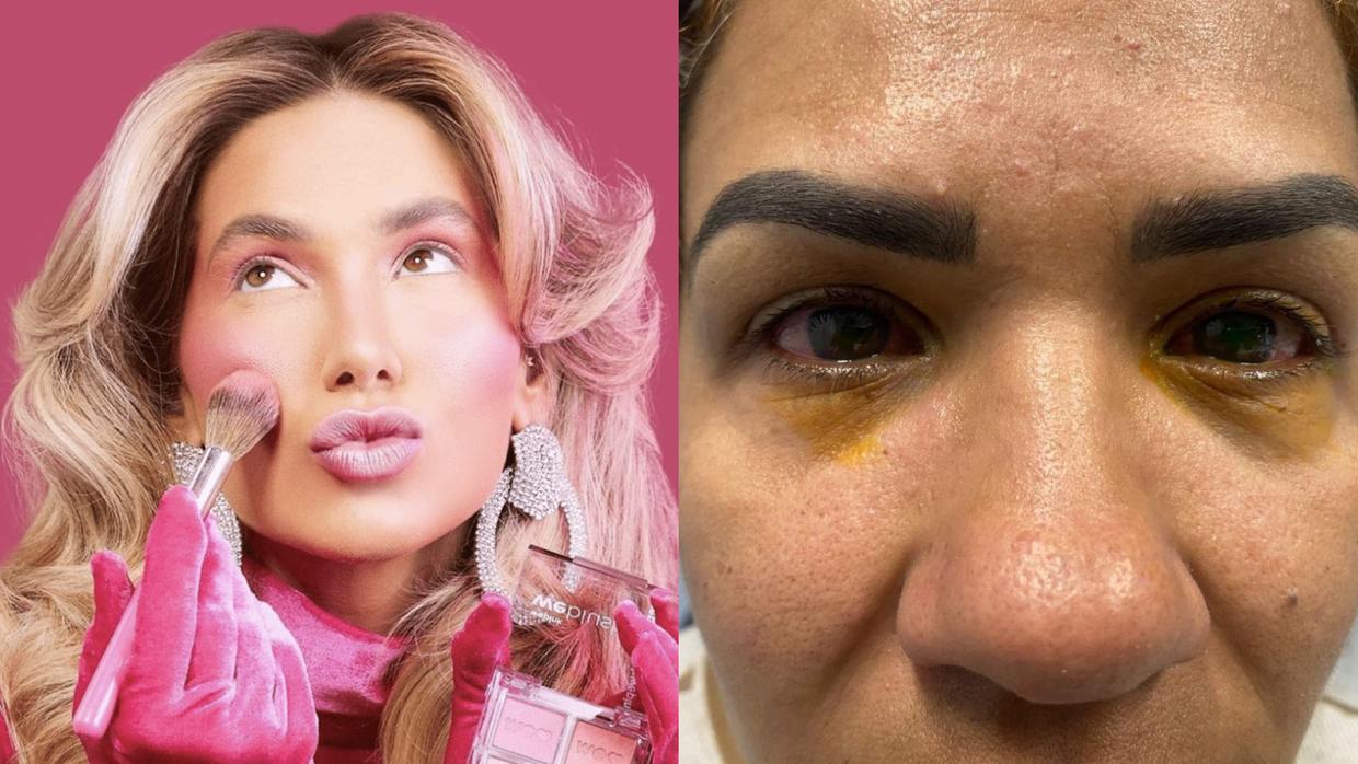 Imagem - Mulher relata cegueira após usar maquiagem de Virginia Fonseca