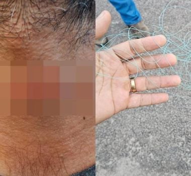 Imagem - Motociclista é ferido por linha chilena em via pública no Pará