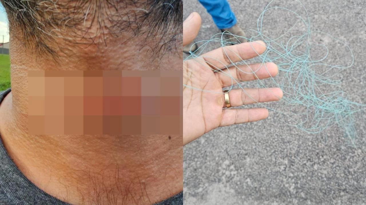 Imagem - Motociclista é ferido por linha chilena em via pública no Pará