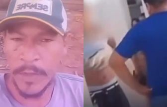 Paraense nega que tenha tirado vegetal de partes íntimas após vídeo em UPA repercutir nas redes; assista
