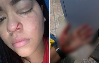 Jovem é agredida após defender mulher em briga de casal em Belém