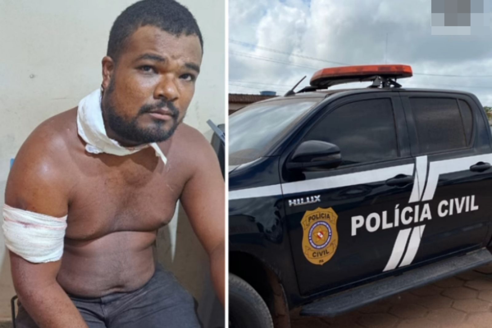Homem esfaqueado vai à delegacia e é preso ao ter mandado de prisão descoberto no Pará.