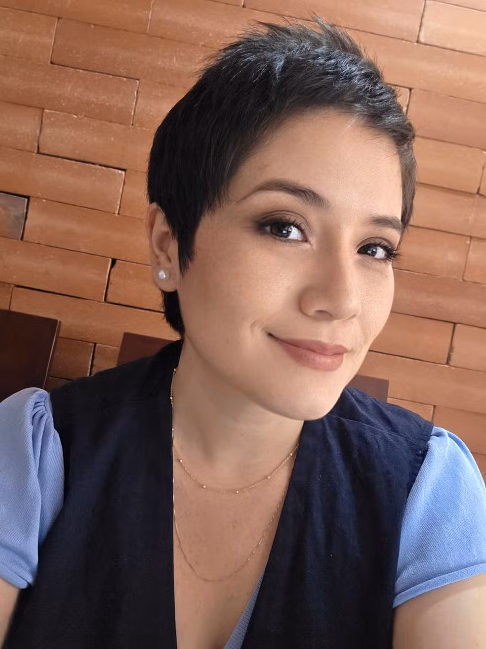 Imagem - Colombiana é a primeira no mundo a passar por cirurgia para depressão