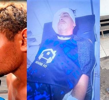 Imagem - Briga entre cunhados termina com ‘enxadada’ e prisão no interior do Pará