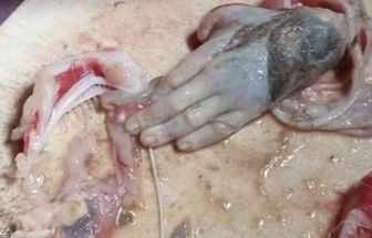 Pescador encontra mão idêntica de um humano dentro de um peixe gigante