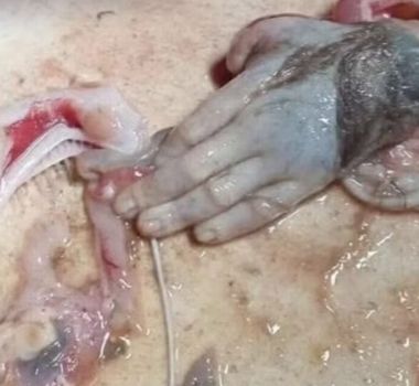 Imagem - Pescador encontra mão idêntica de um humano dentro de um peixe gigante